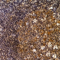  - Anti-DAP Kinase 2 Antibody AP61114